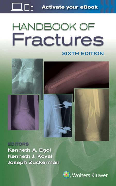 Handbook of Fractures  6th Edition