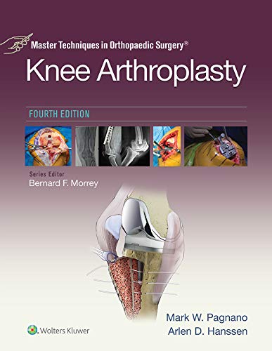 Master Techniques in Orthopedic Surgery: Knee Arthroplasty (Master Techniques in Orthopaedic Surgery)