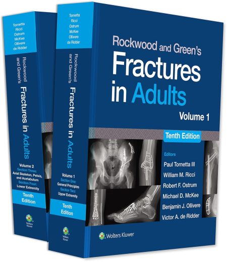 Rockwood and Green's Fractures in Adults: eBook without Multimedia 10th Edition