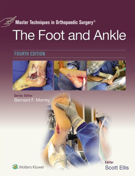 Master Techniques in Orthopaedic Surgery: The Foot and Ankle, 4th Edition (EPUB +PDF+ Videos)