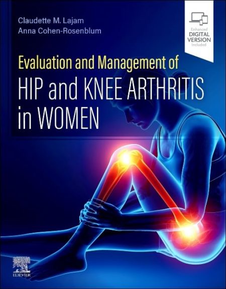 Evaluation and Management of Hip and Knee Arthritis in Women 1st Edition-2025