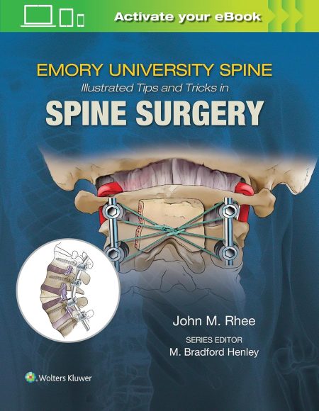 Emory's Illustrated Tips and Tricks in Spine Surgery 1st Edition