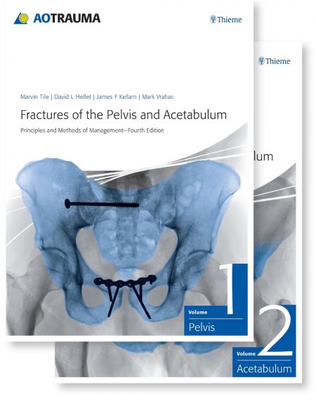 Fractures of the Pelvis and Acetabulum: Principles and Methods of Management 4th Edition