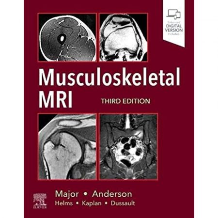 Musculoskeletal MRI  3rd Edition