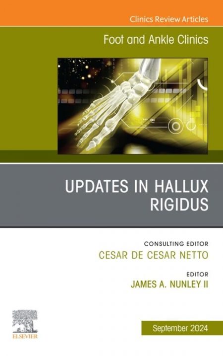 Updates in Hallux Rigidus, An issue of Foot and Ankle Clinics of North America, E-Book (The Clinics: Orthopedics)