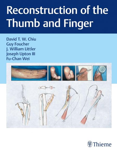 Reconstruction of the Thumb and Finger 1st Edition