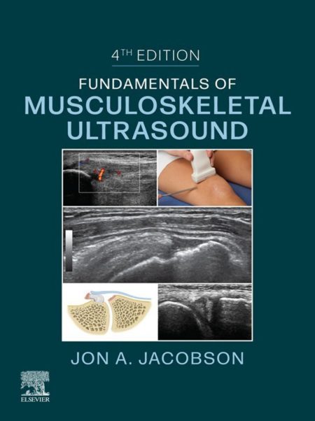 Fundamentals of Musculoskeletal Ultrasound, 4th Edition (EPUB)
