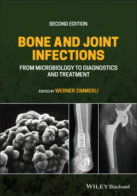 Bone and Joint Infections: From Microbiology to Diagnostics and Treatment, 2nd Edition (EPUB)