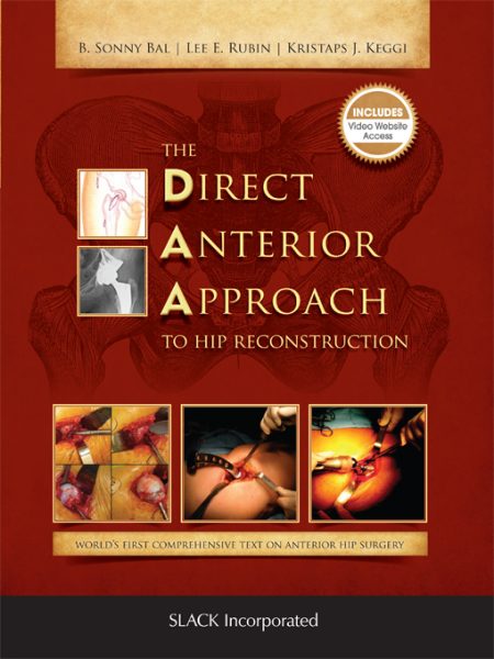 The Direct Anterior Approach to Hip Reconstruction