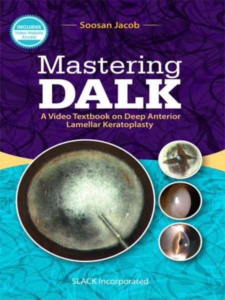 Mastering DALK: A Video Textbook on Deep Anterior Lamellar Keratoplasty (Original PDF from Publisher)