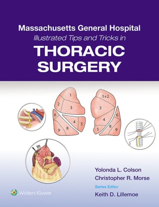 Massachusetts General Hospital Illustrated Tips and Tricks in Thoracic Surgery (EPUB)