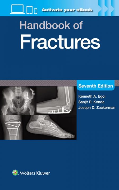 Handbook of Fractures, 7th Edition (EPUB)