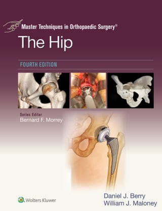 Master Techniques in Orthopaedic Surgery: The Hip, 4th Edition (EPUB)