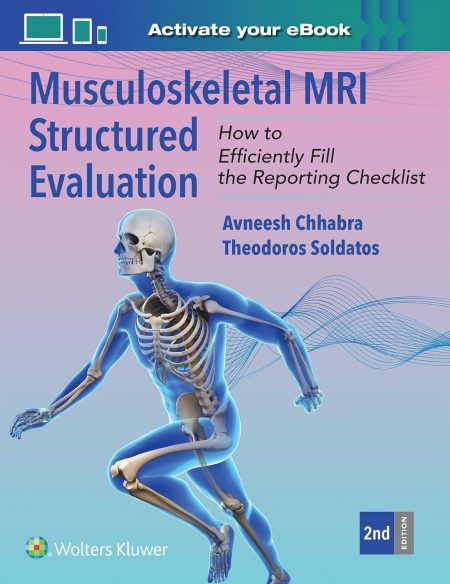 Musculoskeletal MRI Structured Evaluation: How to Efficiently Fill in the Reporting Checklist (EPUB)