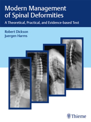 Modern Management of Spinal Deformities (EPUB)