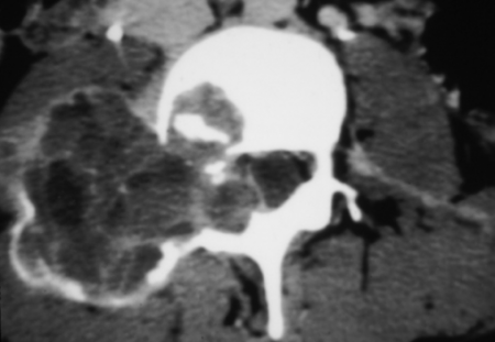 MRI Mastery Series: Degenerative Joint Disease (DJD) 2020